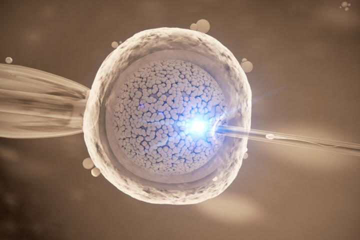 icsi iniezione intracitoplasmatica degli spermatozoi