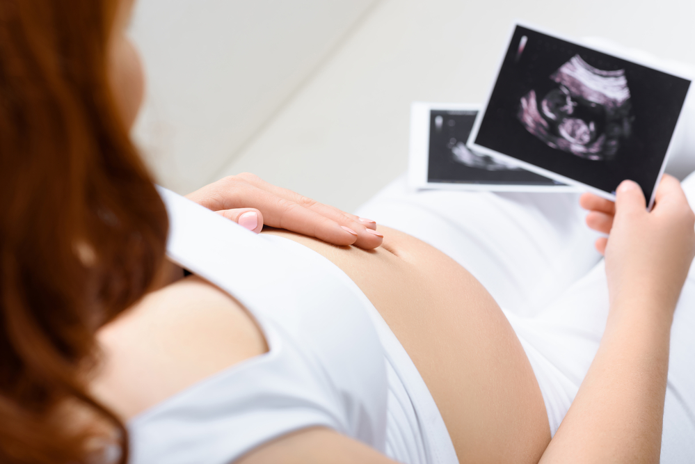 Donna incinta osserva l'ecografia per determinare il sesso del bambino con la Nub Theory