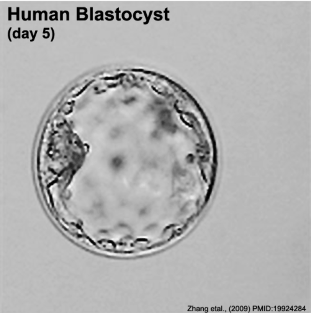 La blastocisti vista al microscopio