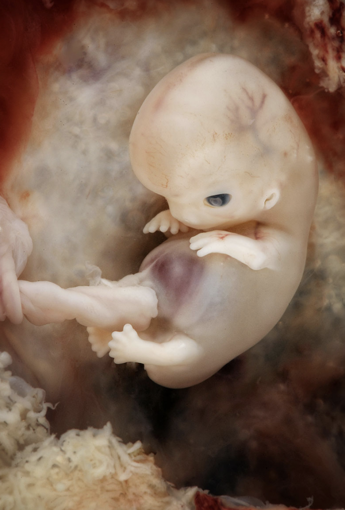 stadio 21 sviluppo embrionale