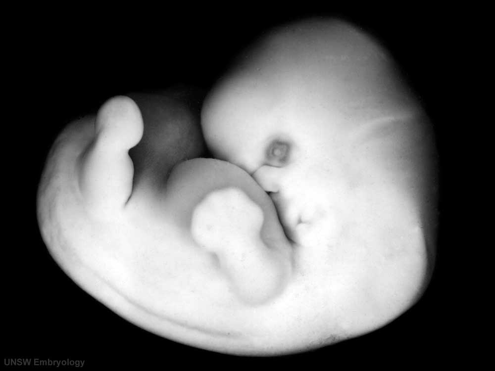 stadio 18 sviluppo embrionale