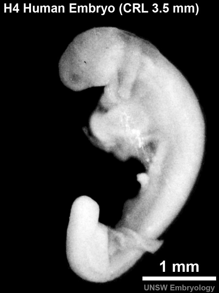 stadio 12 sviluppo embrionale