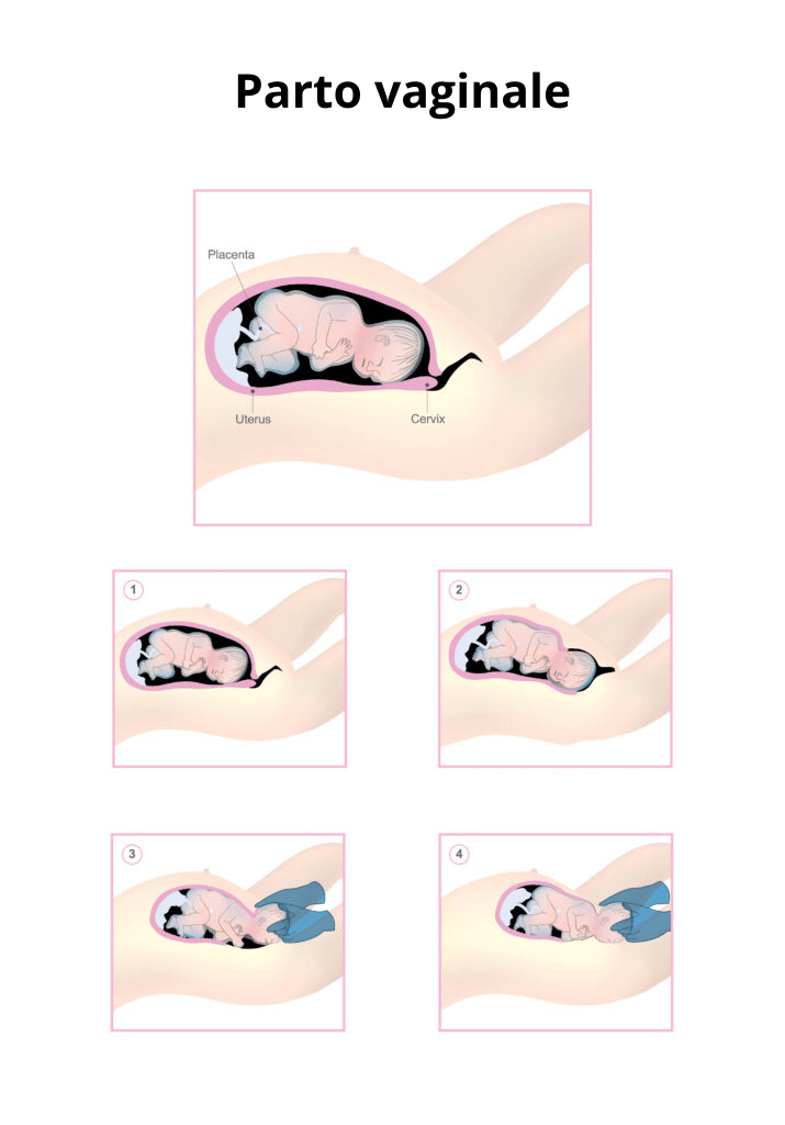 Dilatazione parto immagine 9: fasi del parto naturale parto vaginale