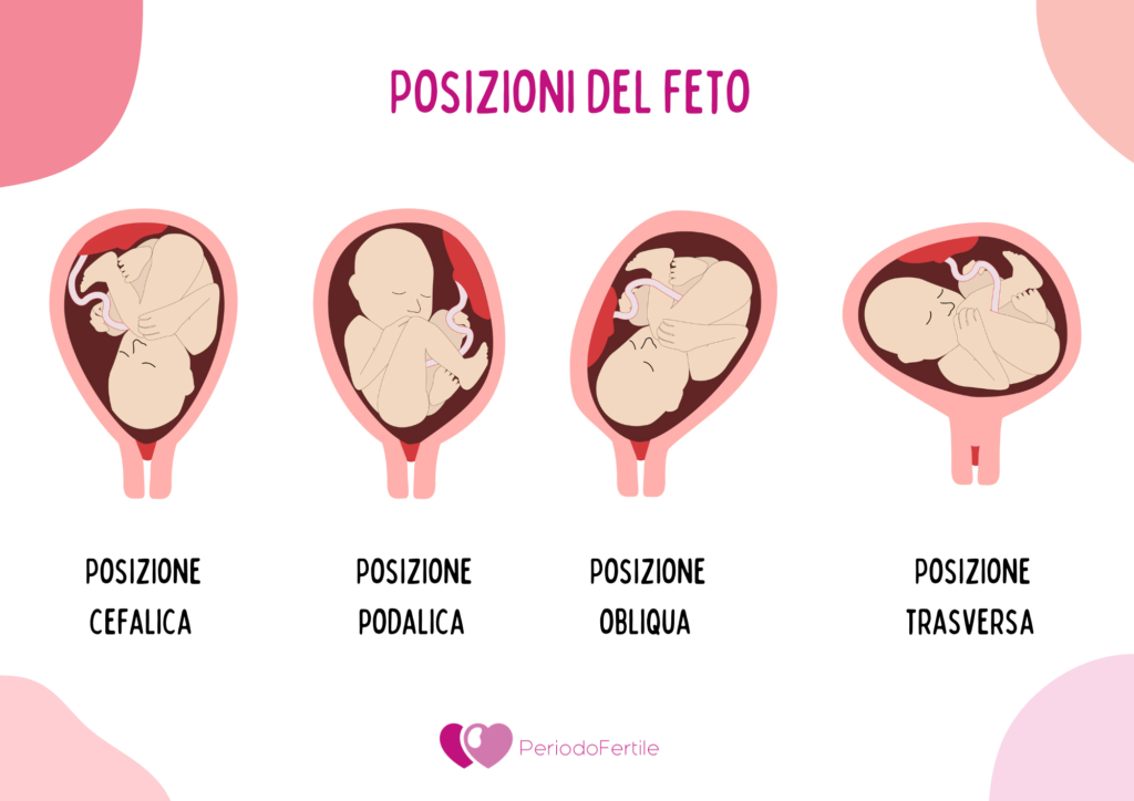Posizioni del feto nell'utero: cefalica, podalica, obliqua e trasversa